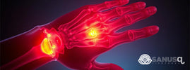 Articulations en forme : Adoptez ces gestes simples pour éviter l'arthrite