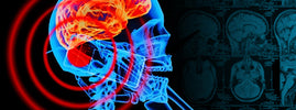 Radiographie d'un crâne et d'un cerveau exposés aux ondes d'un téléphone portable, risque de cancer – SANUSq Health